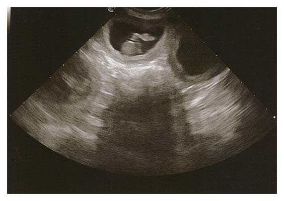 Sonogram2